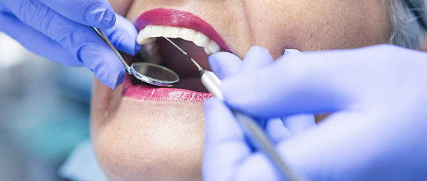 Best Dental Abscess Treatment in Francisville, KY